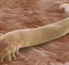 Demodex folliculorum ou la mite des cils!