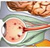 LE SYNDROME DU BÉBÉ SECOUÉ ET LES YEUX